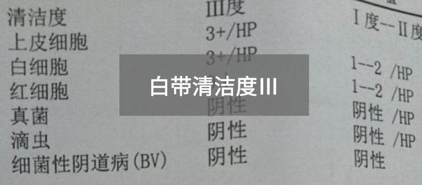 今天快讯！全自动白带麻豆高清黄色视频生产厂家麻豆电影在线观看为您官方解释白带清洁度3的意思