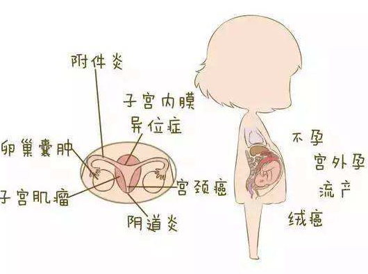 阴道分泌物麻豆影视在线直播视频分析阴道炎早期症状