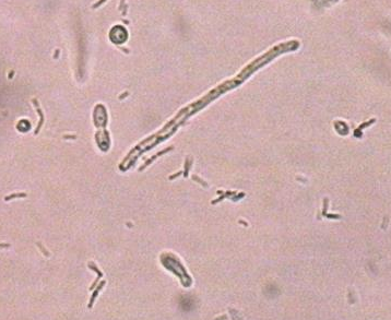 白带常规麻豆影视在线直播视频厂家分析白带常规检查白细胞的意义