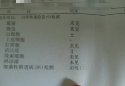 全自动白带麻豆高清黄色视频分享如何看懂白带常规检测报告单